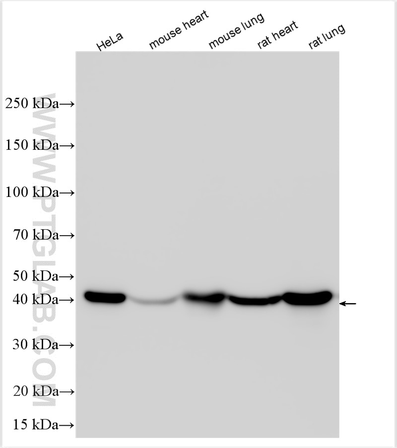 Western Blot (WB) analysis of various lysates using CAPG Polyclonal antibody (10194-1-AP)