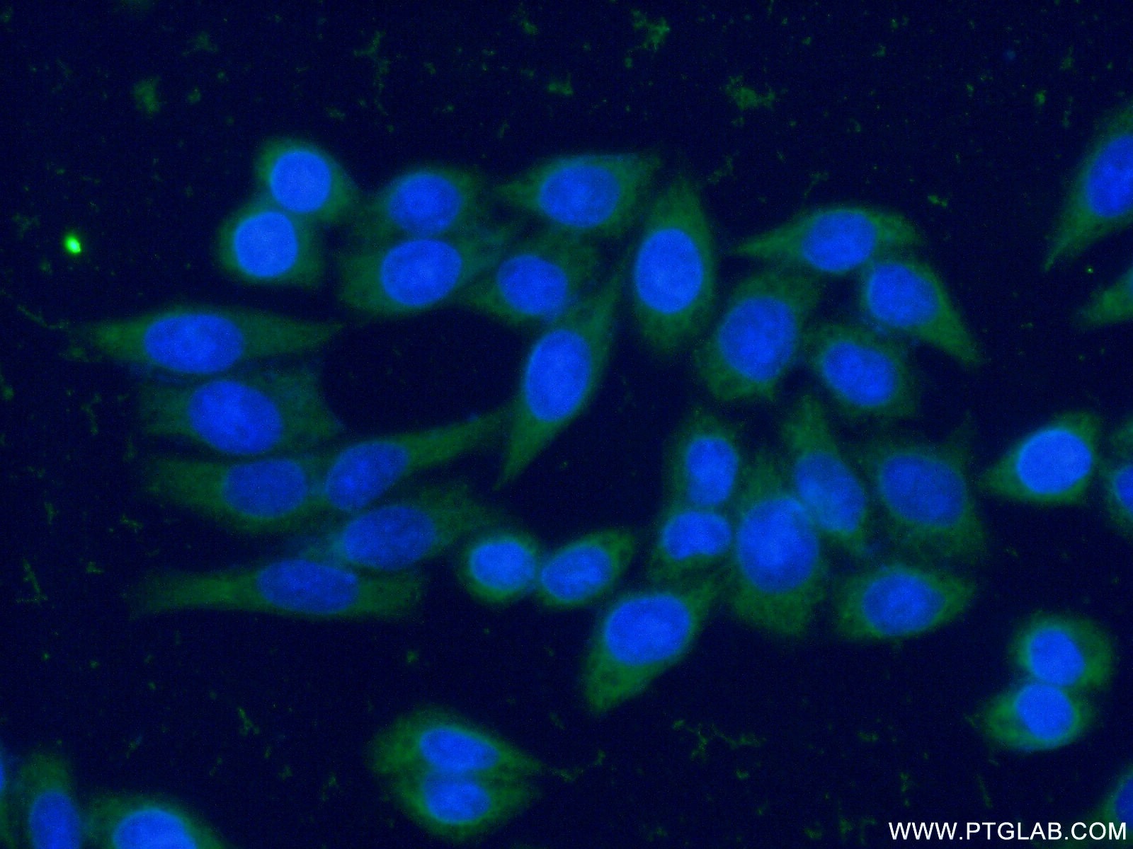 Immunofluorescence (IF) / fluorescent staining of HeLa cells using CAPG Monoclonal antibody (66277-1-Ig)