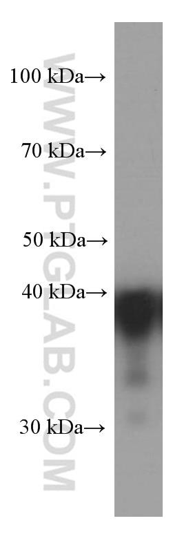 Western Blot (WB) analysis of Jurkat cells using CAPG Monoclonal antibody (66277-1-Ig)