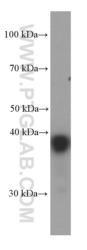 Western Blot (WB) analysis of HeLa cells using CAPG Monoclonal antibody (66277-1-Ig)