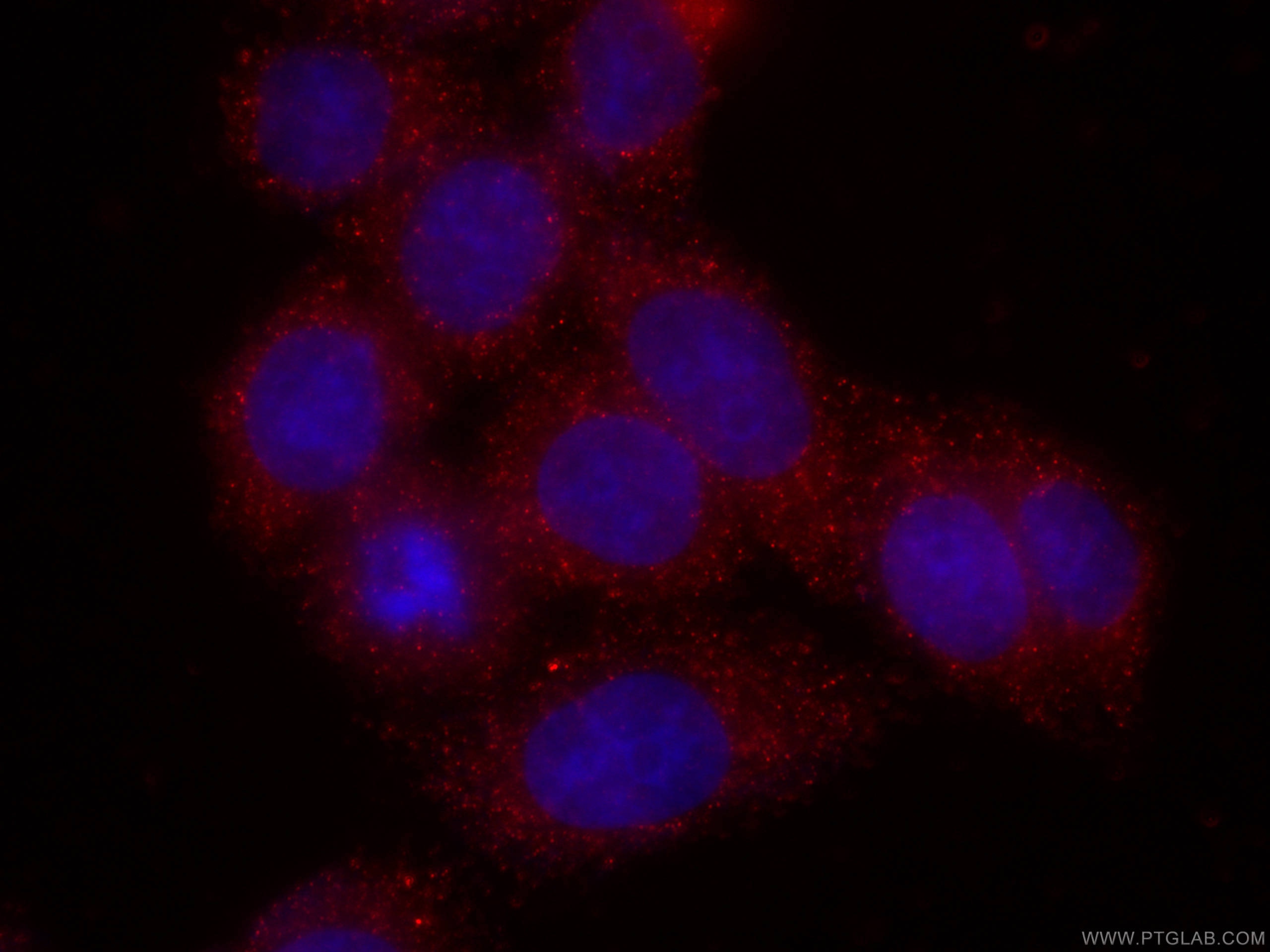 Immunofluorescence (IF) / fluorescent staining of HeLa cells using CoraLite®594-conjugated CAPG Monoclonal antibody (CL594-66277)