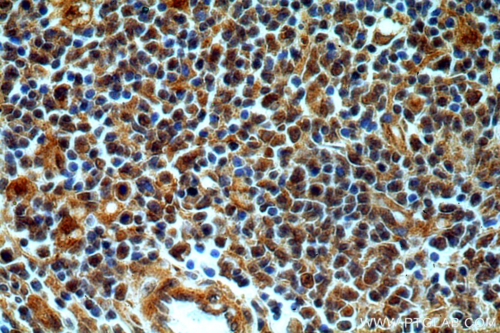 Immunohistochemistry (IHC) staining of human spleen tissue using CAPG-Specific Polyclonal antibody (19535-1-AP)