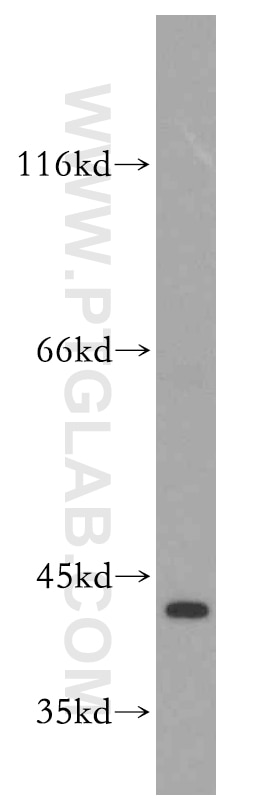 Western Blot (WB) analysis of mouse lung tissue using CAPG-Specific Polyclonal antibody (19535-1-AP)