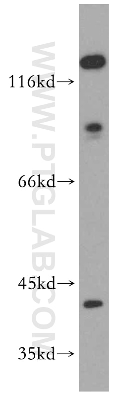 Western Blot (WB) analysis of mouse kidney tissue using CAPG-Specific Polyclonal antibody (19535-1-AP)