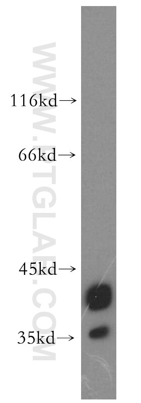 Western Blot (WB) analysis of U-937 cells using CAPG-Specific Polyclonal antibody (19535-1-AP)