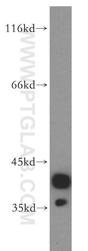 Western Blot (WB) analysis of U-937 cells using CAPG-Specific Polyclonal antibody (19535-1-AP)