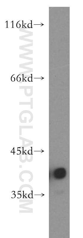 Western Blot (WB) analysis of U-937 cells using CAPG-Specific Polyclonal antibody (19535-1-AP)