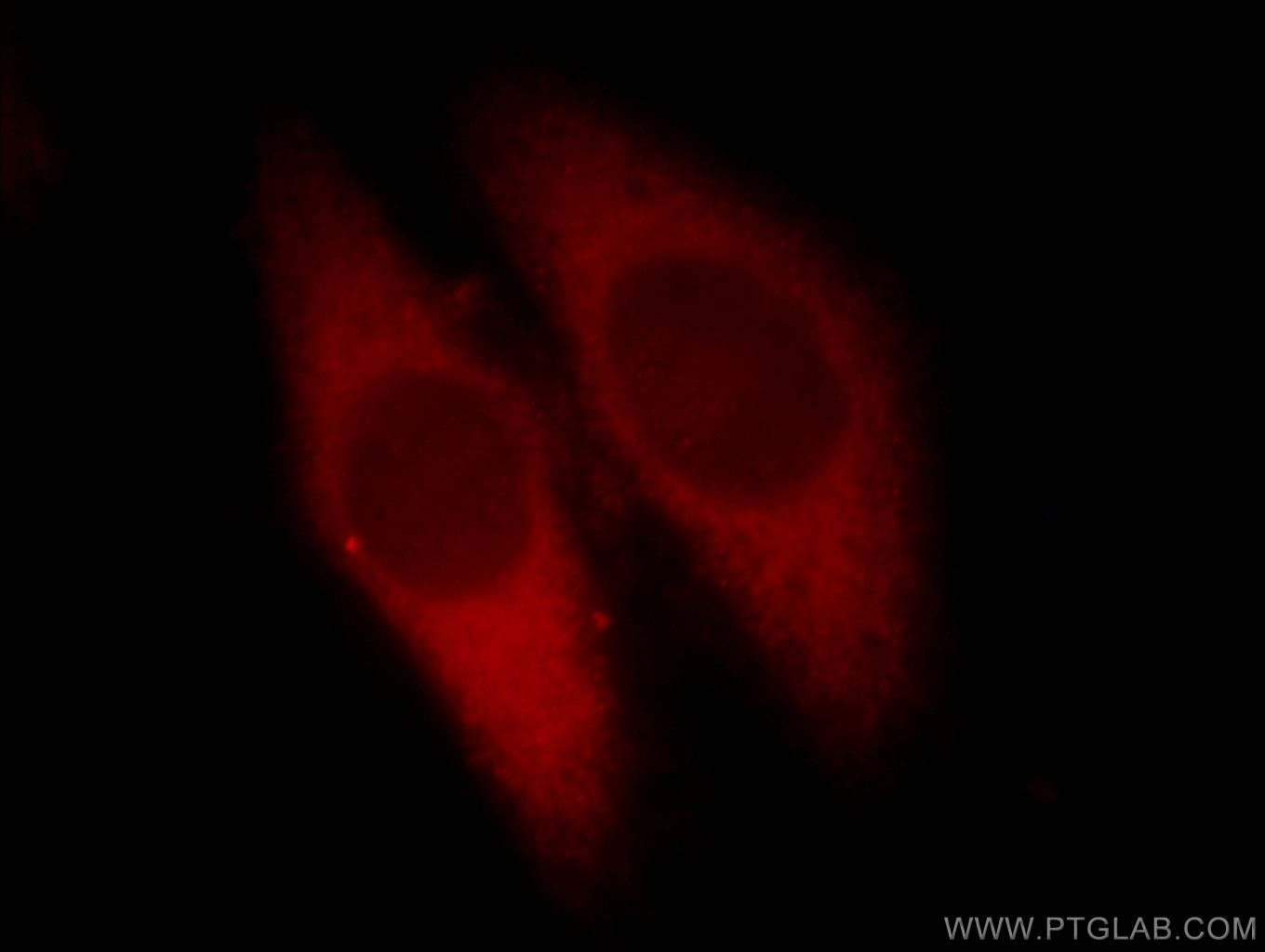 Immunofluorescence (IF) / fluorescent staining of HeLa cells using Calpain 1 Polyclonal antibody (10538-1-AP)