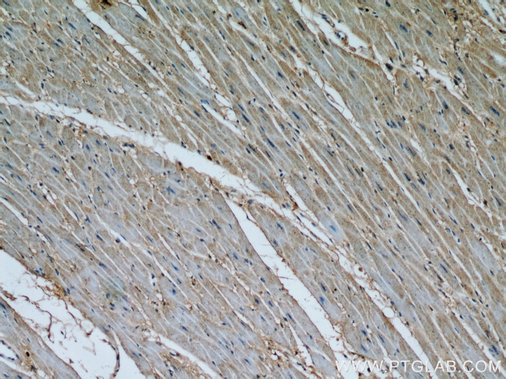 IHC staining of human heart using 10538-1-AP