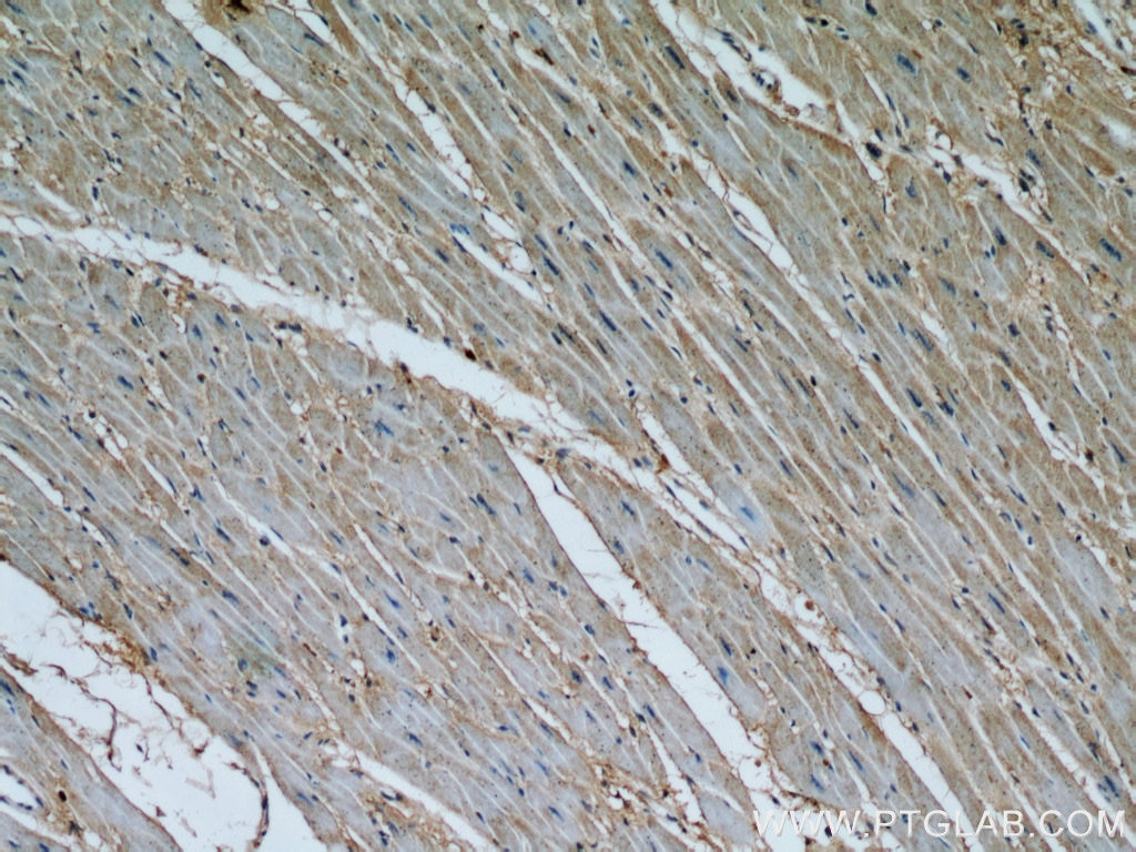 Immunohistochemistry (IHC) staining of human heart tissue using Calpain 1 Polyclonal antibody (10538-1-AP)