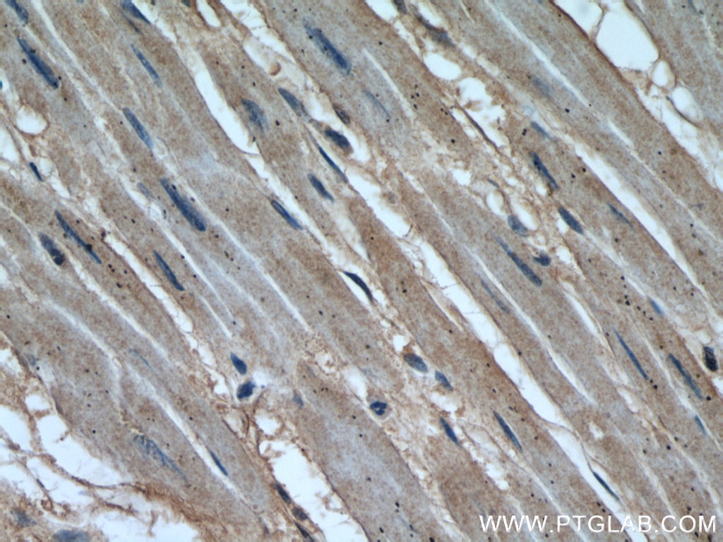 Immunohistochemistry (IHC) staining of human heart tissue using Calpain 1 Polyclonal antibody (10538-1-AP)