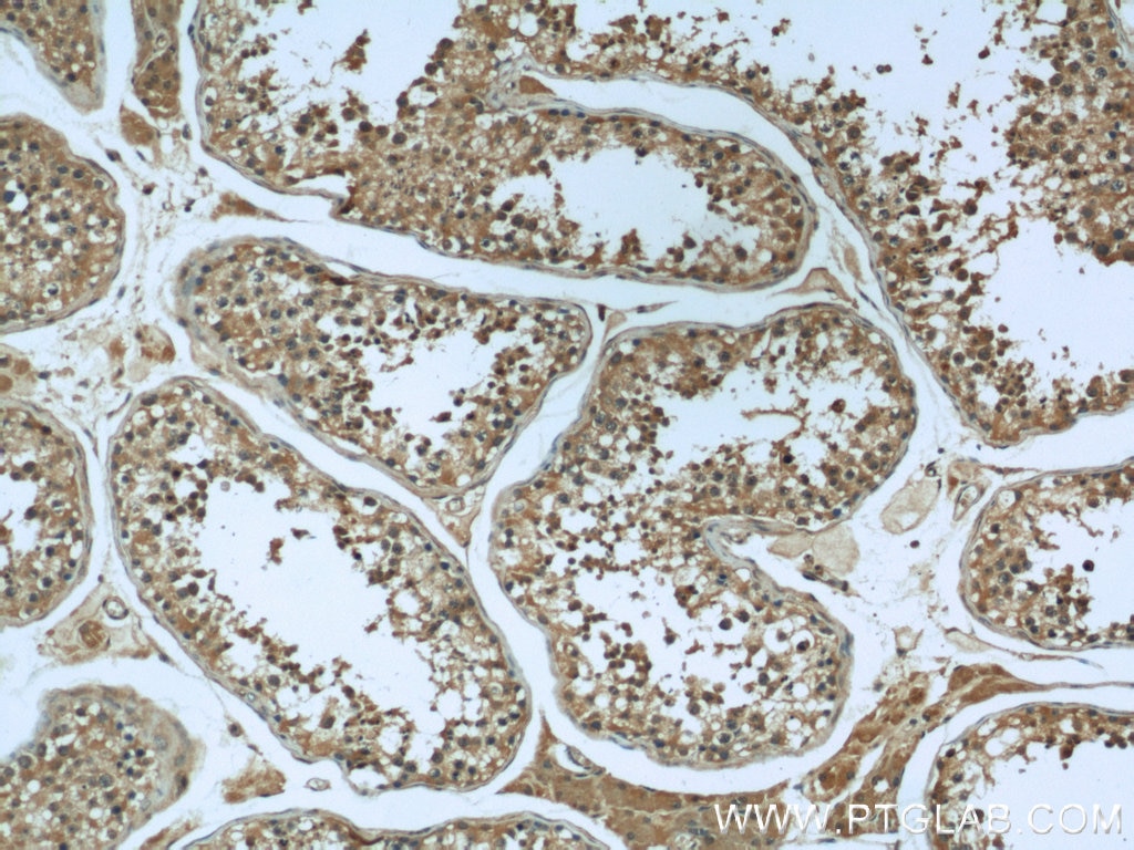 IHC staining of human testis using 10538-1-AP