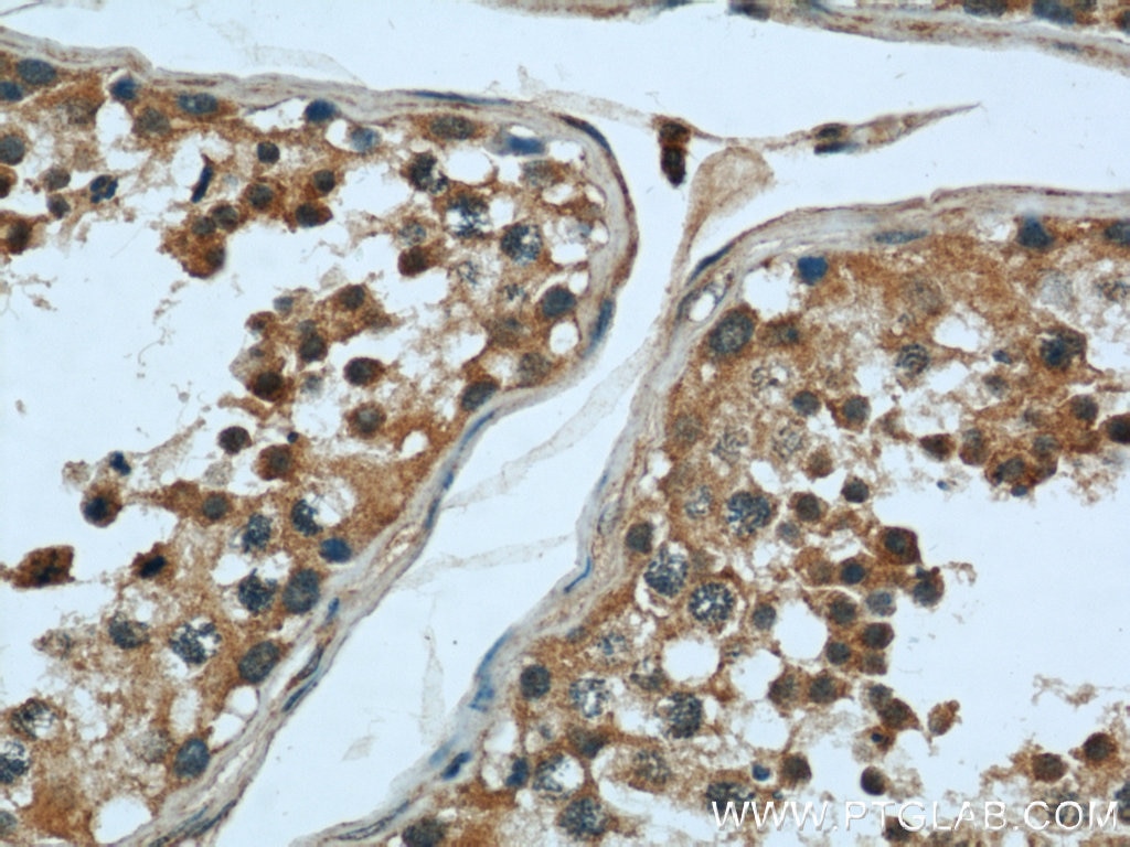 Immunohistochemistry (IHC) staining of human testis tissue using Calpain 1 Polyclonal antibody (10538-1-AP)