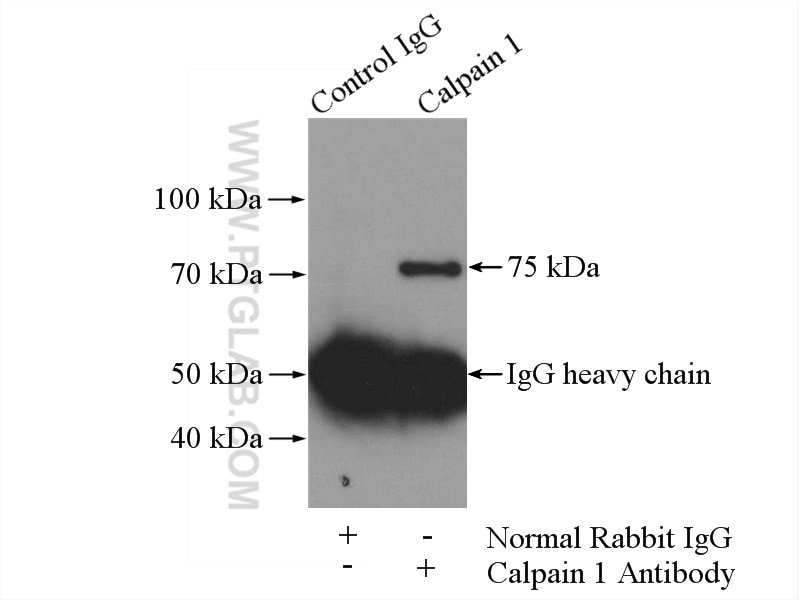 Immunoprecipitation (IP) experiment of HeLa cells using Calpain 1 Polyclonal antibody (10538-1-AP)