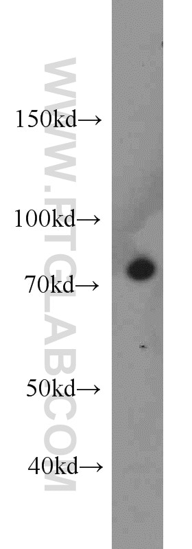 Western Blot (WB) analysis of A431 cells using Calpain 1 Polyclonal antibody (10538-1-AP)