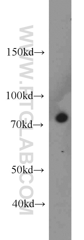 WB analysis of A431 using 10538-1-AP