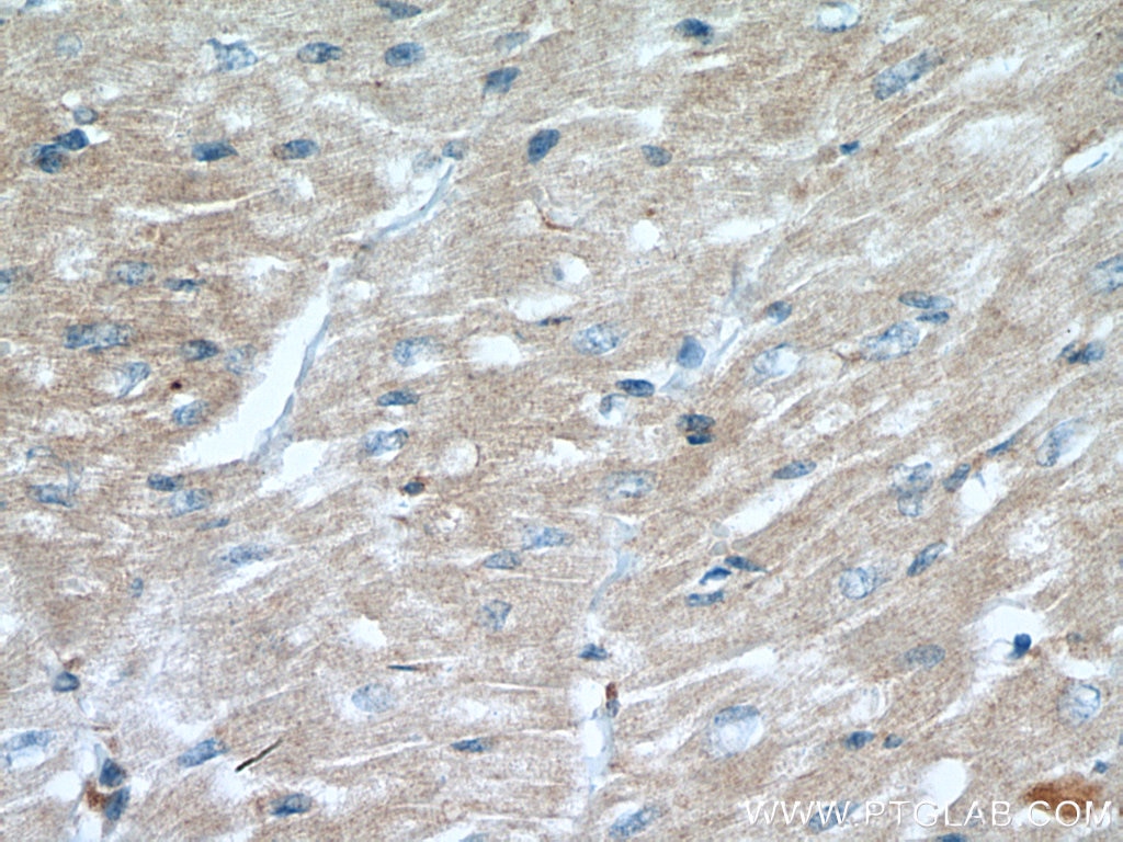 Immunohistochemistry (IHC) staining of human heart tissue using CAPN1 Monoclonal antibody (67732-1-Ig)