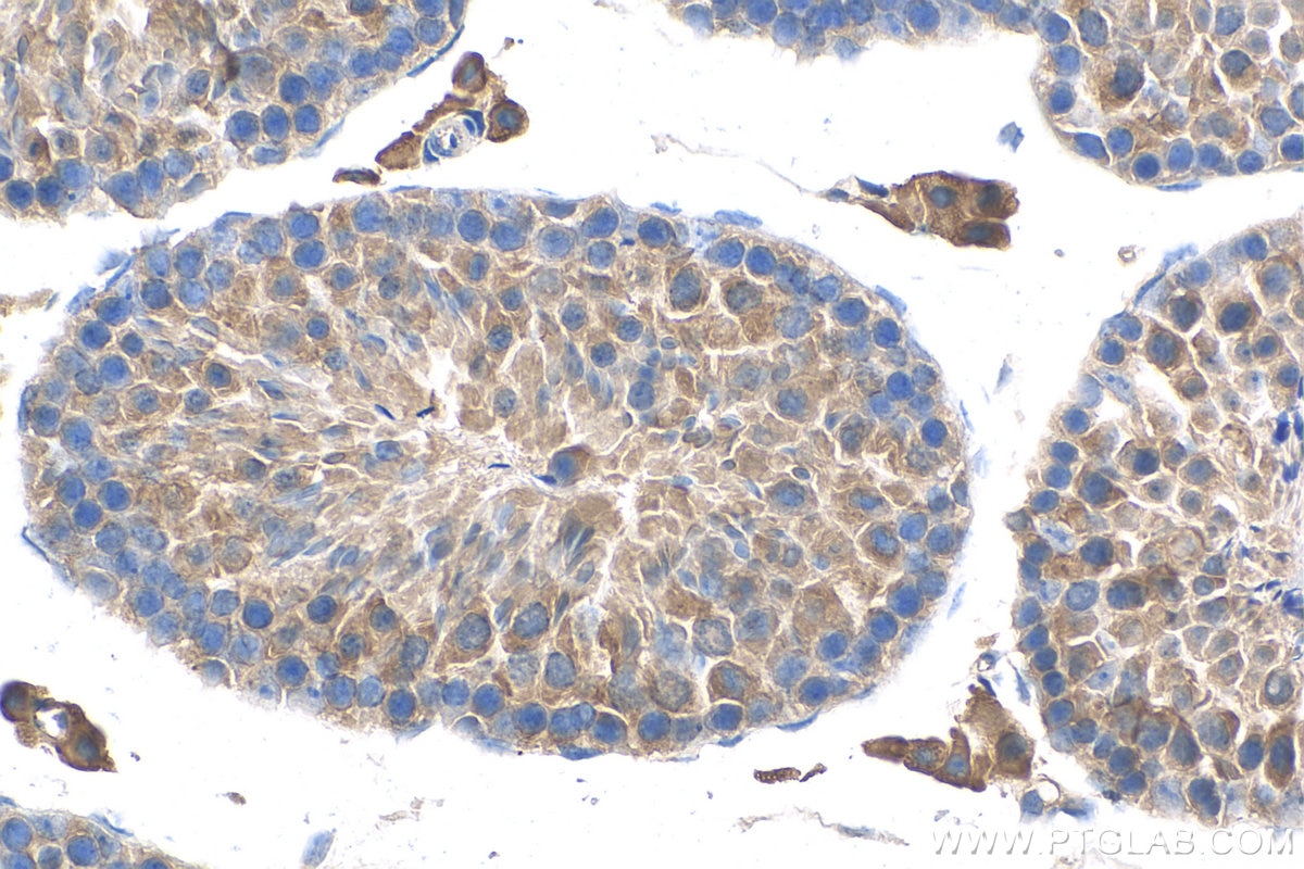 Immunohistochemistry (IHC) staining of mouse testis tissue using Calpain 11 Polyclonal antibody (13675-1-AP)