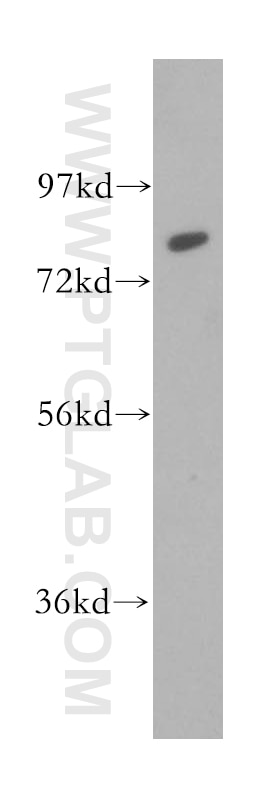 Western Blot (WB) analysis of PC-3 cells using Calpain 11 Polyclonal antibody (13675-1-AP)