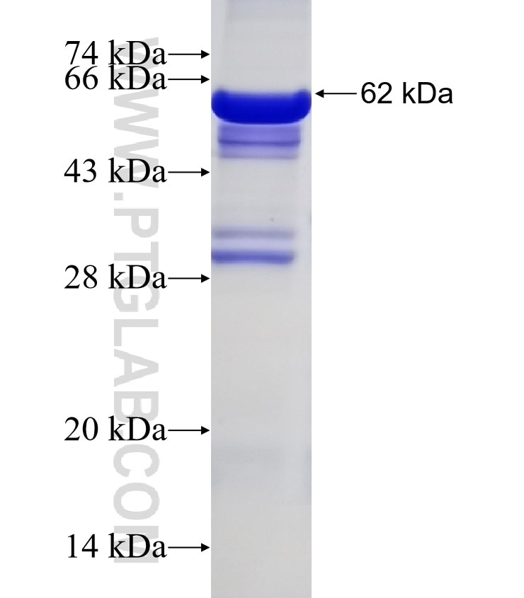 CAPN11 fusion protein Ag4668 SDS-PAGE