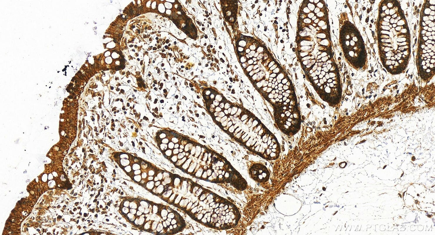Immunohistochemistry (IHC) staining of human colon tissue using CAPN13 Polyclonal antibody (55371-1-AP)
