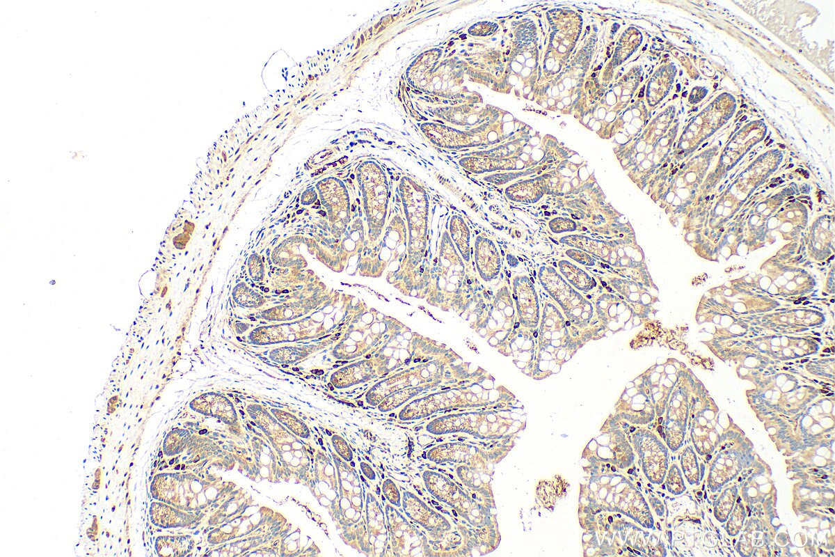 Immunohistochemistry (IHC) staining of mouse colon tissue using CAPN13 Polyclonal antibody (55371-1-AP)