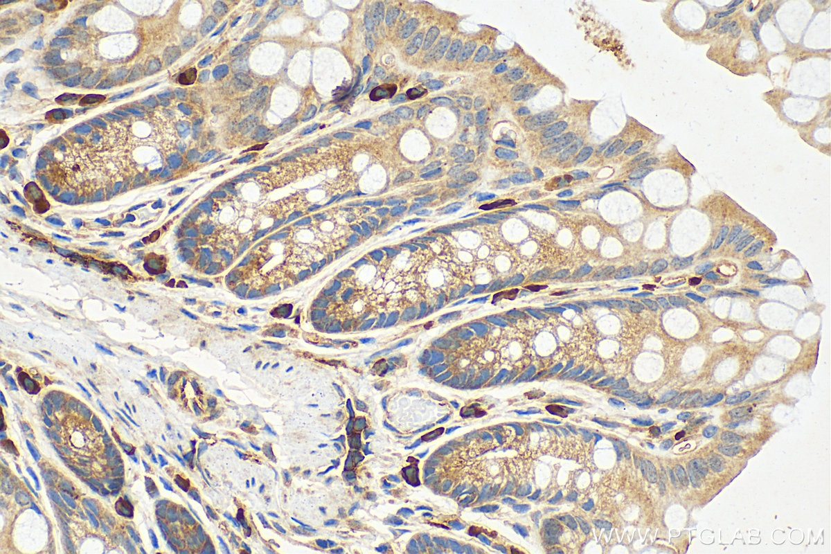 Immunohistochemistry (IHC) staining of mouse colon tissue using CAPN13 Polyclonal antibody (55371-1-AP)
