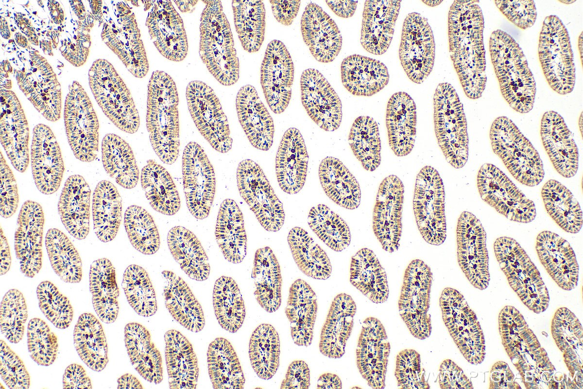 Immunohistochemistry (IHC) staining of mouse small intestine tissue using CAPN13 Polyclonal antibody (55371-1-AP)