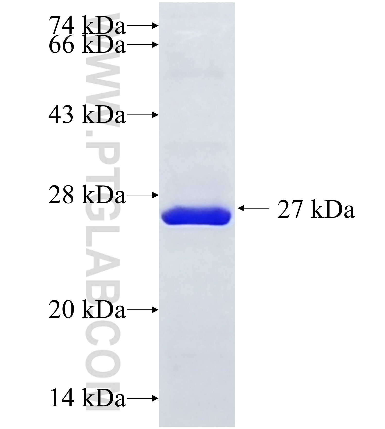 CAPN14 fusion protein Ag37212 SDS-PAGE
