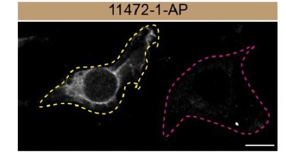 Immunofluorescence (IF) / fluorescent staining of MDA-MB-231 cells using Calpain 2 Polyclonal antibody (11472-1-AP)