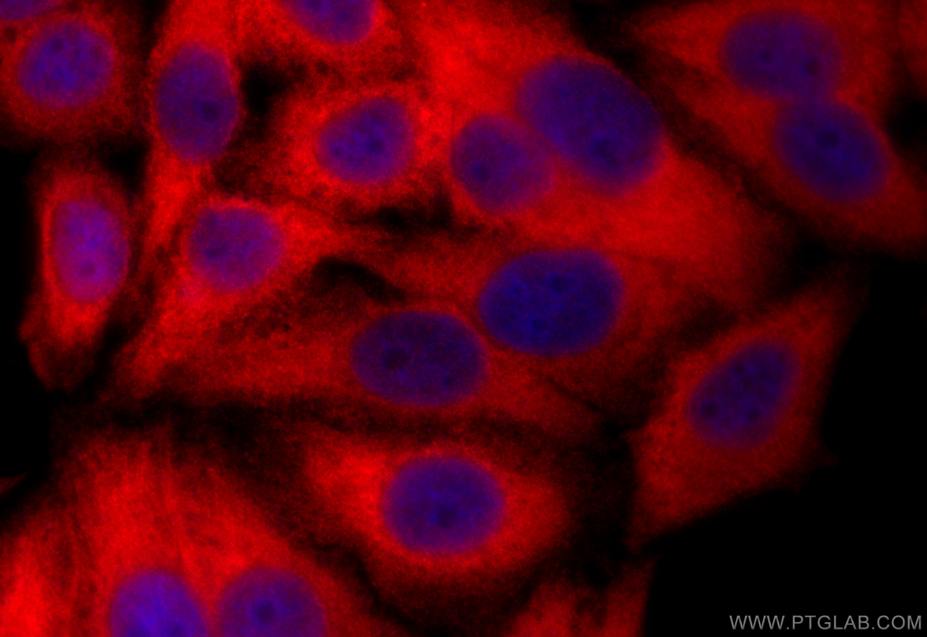 Immunofluorescence (IF) / fluorescent staining of HepG2 cells using Calpain 2 Polyclonal antibody (11472-1-AP)