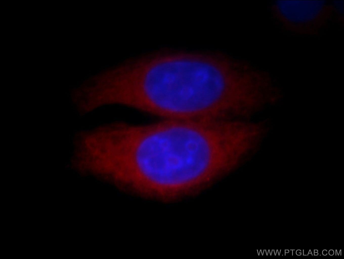 Immunofluorescence (IF) / fluorescent staining of HepG2 cells using Calpain 2 Polyclonal antibody (11472-1-AP)
