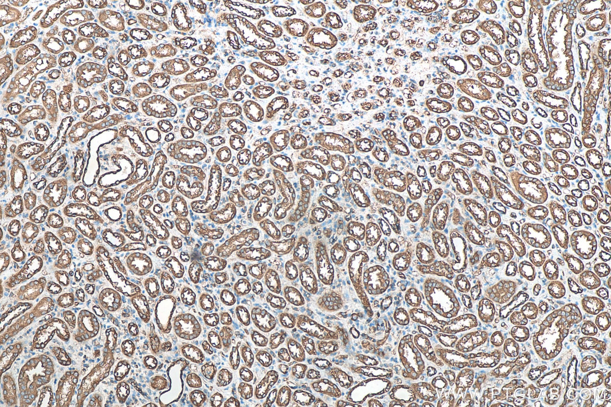 Immunohistochemistry (IHC) staining of human kidney tissue using Calpain 2 Polyclonal antibody (11472-1-AP)