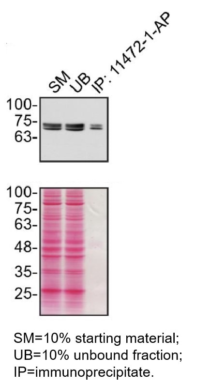 Immunoprecipitation (IP) experiment of MDA-MB-231 cells using Calpain 2 Polyclonal antibody (11472-1-AP)