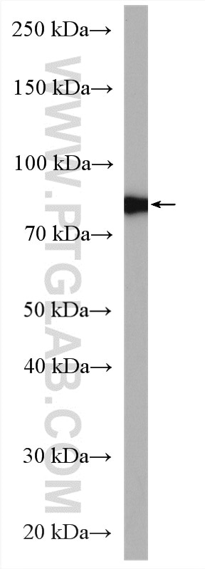 Western Blot (WB) analysis of human placenta tissue using Calpain 2 Polyclonal antibody (11472-1-AP)