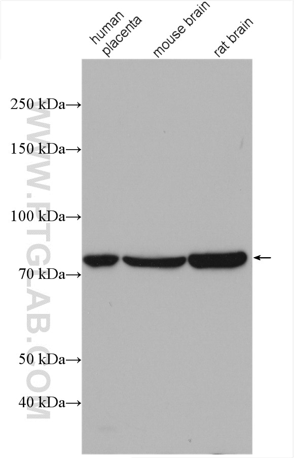 Western Blot (WB) analysis of various lysates using Calpain 2 Polyclonal antibody (11472-1-AP)