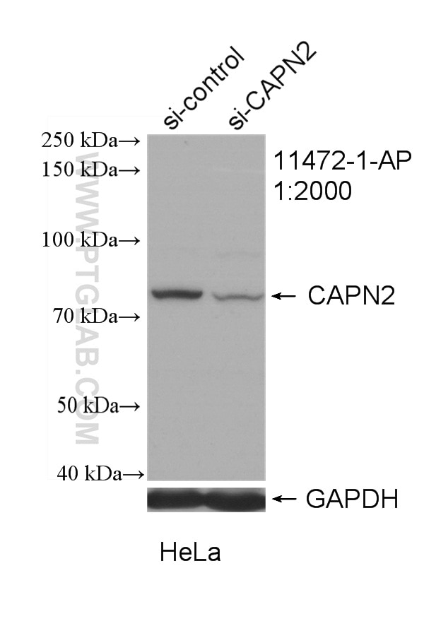 Western Blot (WB) analysis of HeLa cells using Calpain 2 Polyclonal antibody (11472-1-AP)