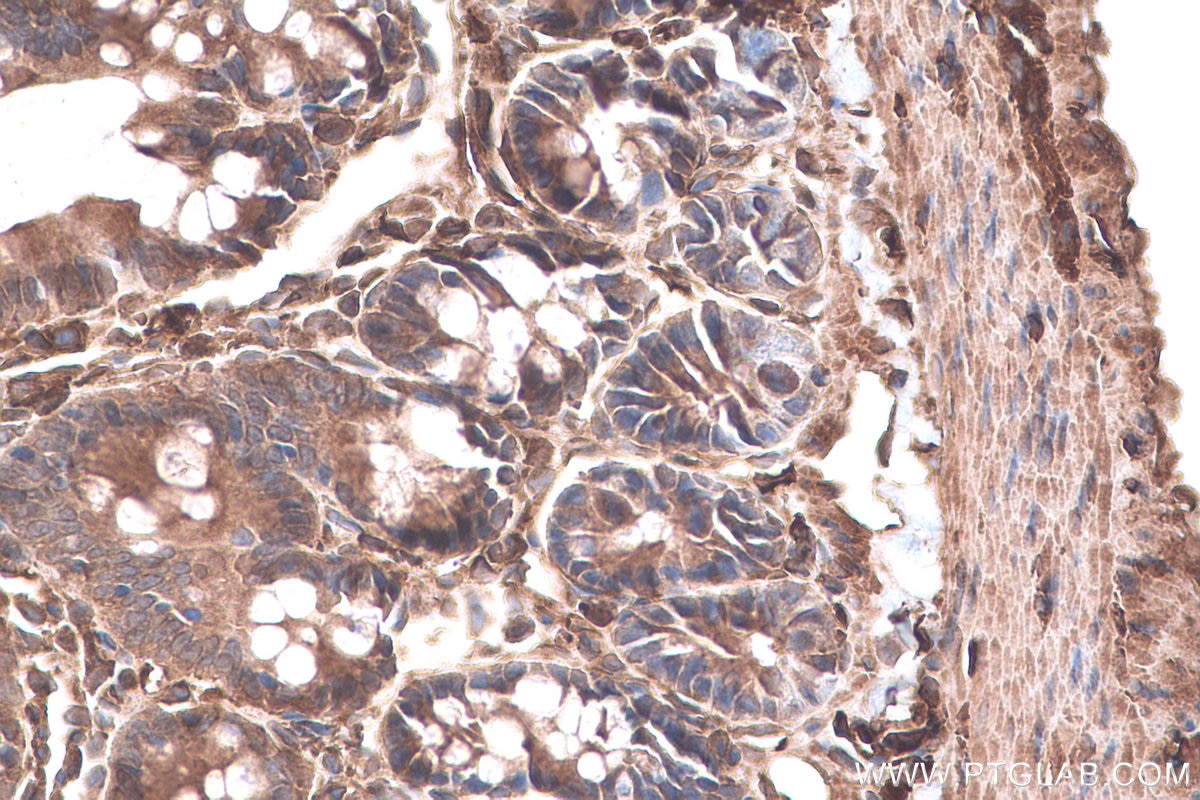 Immunohistochemistry (IHC) staining of rat colon tissue using CAPN2 Monoclonal antibody (66977-1-Ig)