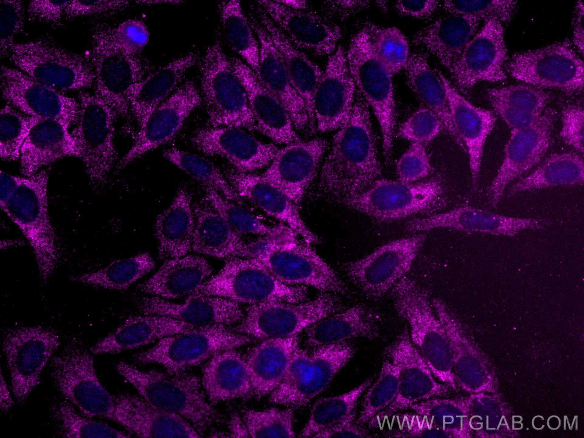 Immunofluorescence (IF) / fluorescent staining of HepG2 cells using CoraLite® Plus 647-conjugated CAPN2 Monoclonal ant (CL647-66977)