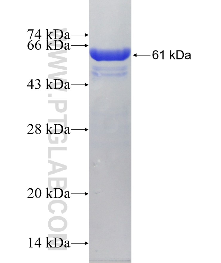 CAPN2 fusion protein Ag2029 SDS-PAGE