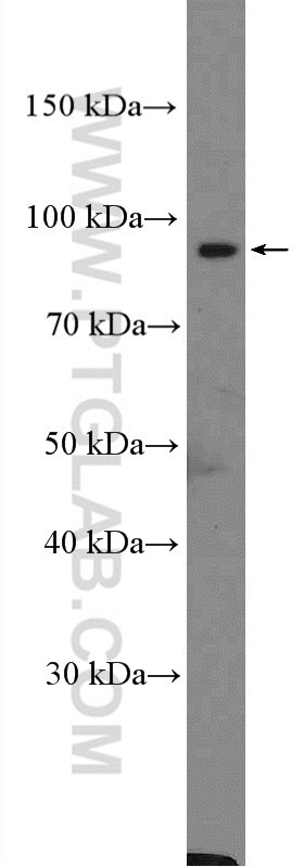 Western Blot (WB) analysis of mouse skeletal muscle tissue using Calpain 3 Polyclonal antibody (10415-1-AP)