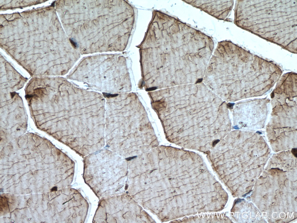 IHC staining of mouse skeletal muscle using 10492-1-AP