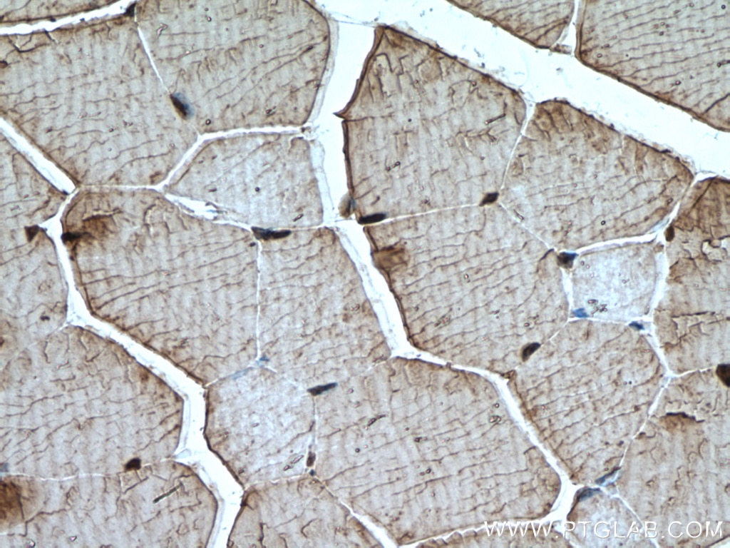 Immunohistochemistry (IHC) staining of mouse skeletal muscle tissue using Calpain 3 Polyclonal antibody (10492-1-AP)