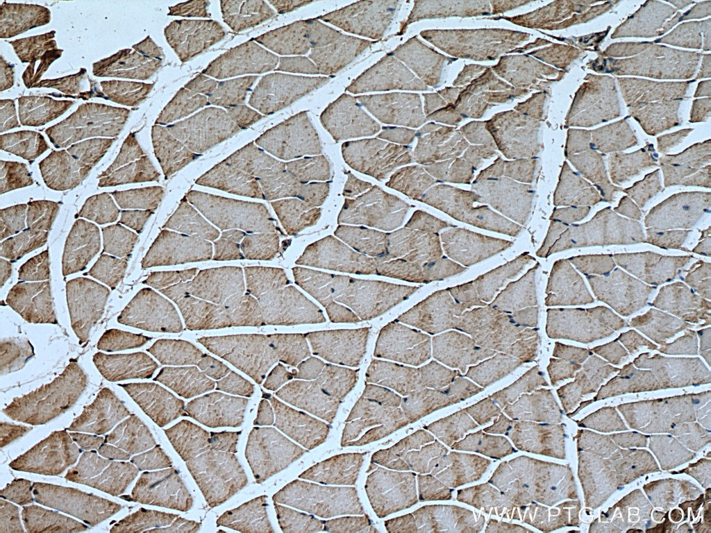 Immunohistochemistry (IHC) staining of mouse skeletal muscle tissue using Calpain 3 Polyclonal antibody (10492-1-AP)