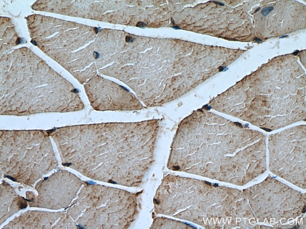 Immunohistochemistry (IHC) staining of mouse skeletal muscle tissue using Calpain 3 Polyclonal antibody (10492-1-AP)