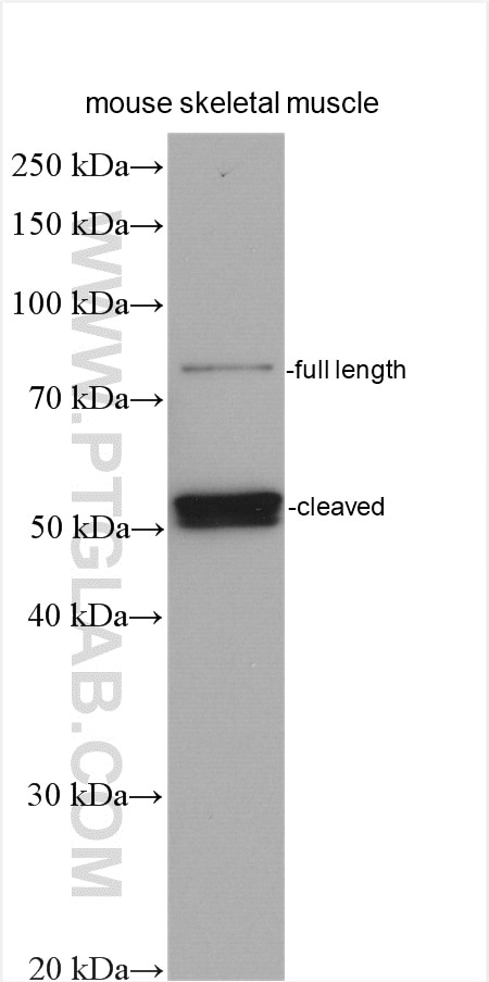 Western Blot (WB) analysis of various lysates using Calpain 3 Polyclonal antibody (10492-1-AP)