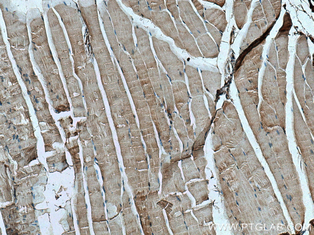 Immunohistochemistry (IHC) staining of mouse skeletal muscle tissue using CAPN3 Polyclonal antibody (28476-1-AP)