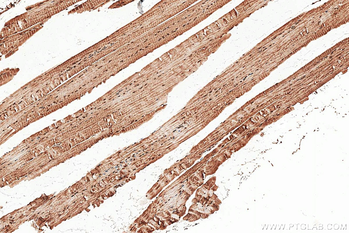 IHC staining of mouse skeletal muscle using 28476-1-AP Immunohistochemistry (IHC) staining of mouse skeletal muscle tissue using Calpain 3 Polyclonal antibody (28476-1-AP)