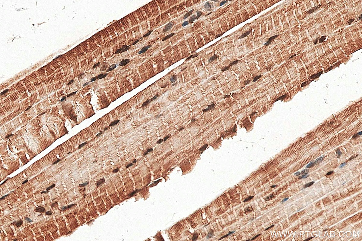 IHC staining of mouse skeletal muscle using 28476-1-AP Immunohistochemistry (IHC) staining of mouse skeletal muscle tissue using Calpain 3 Polyclonal antibody (28476-1-AP)