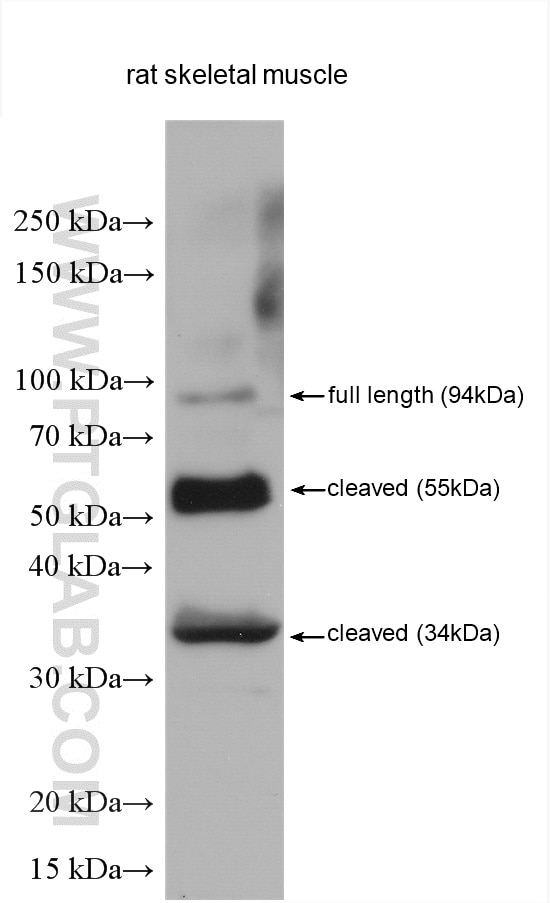 Western Blot (WB) analysis of various lysates using CAPN3 Polyclonal antibody (28476-1-AP)